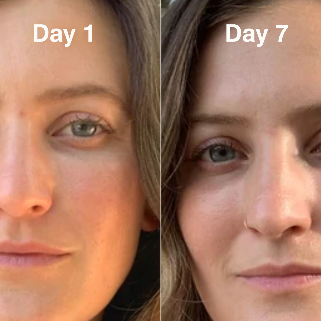 Salmon PDRN Collagen Mask